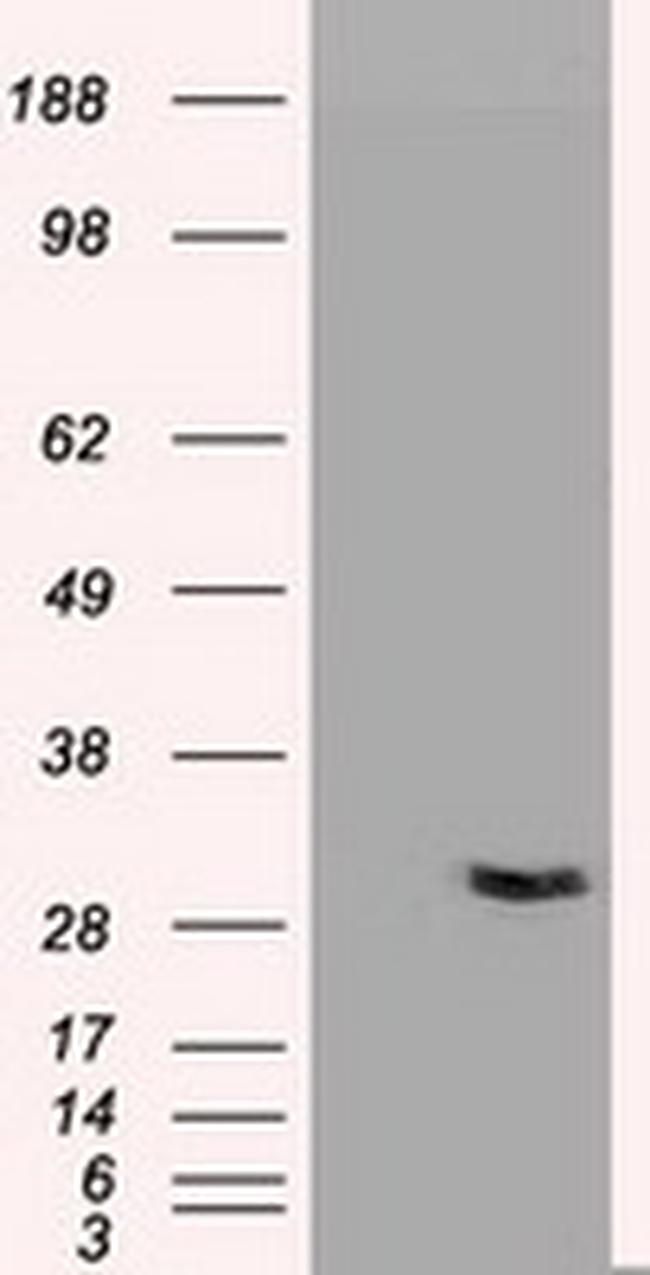 NT3 Antibody in Western Blot (WB)