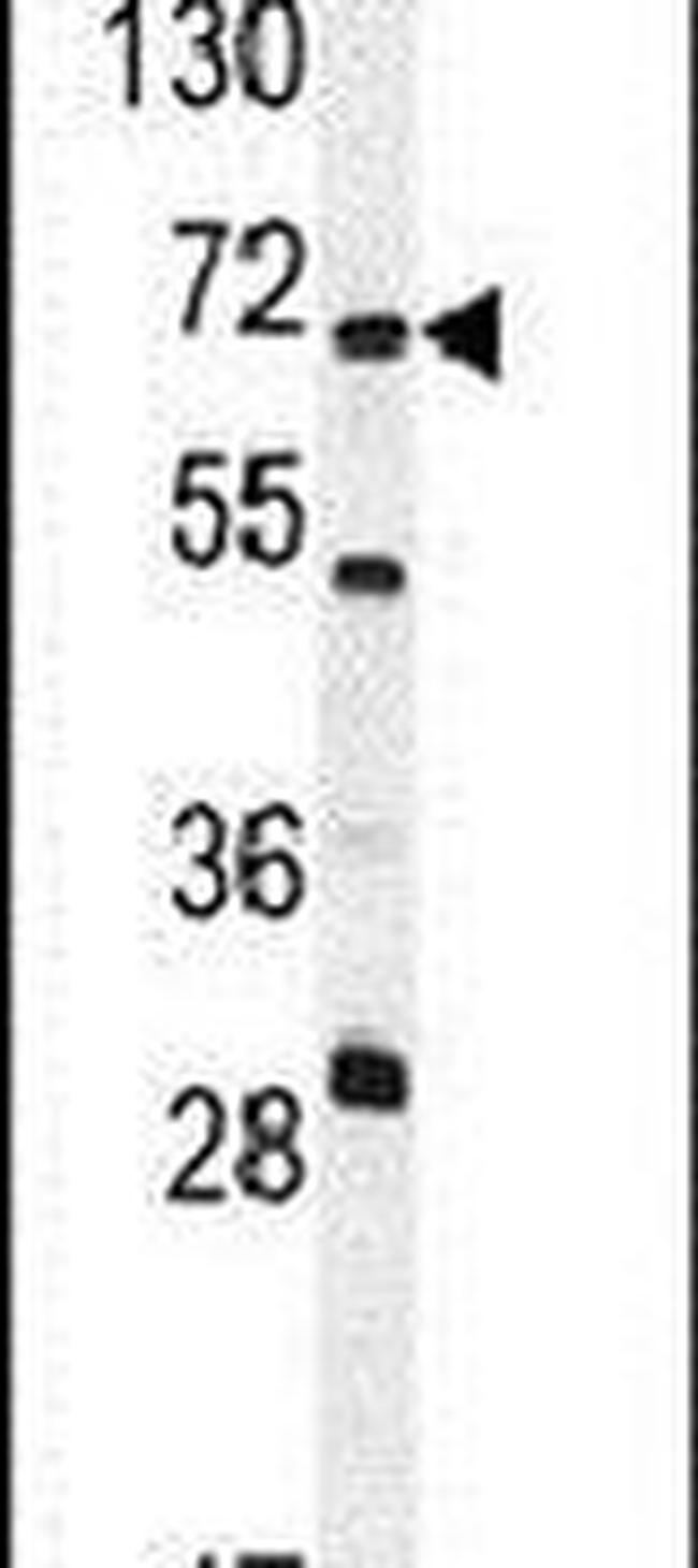 NT5C1B Antibody in Western Blot (WB)