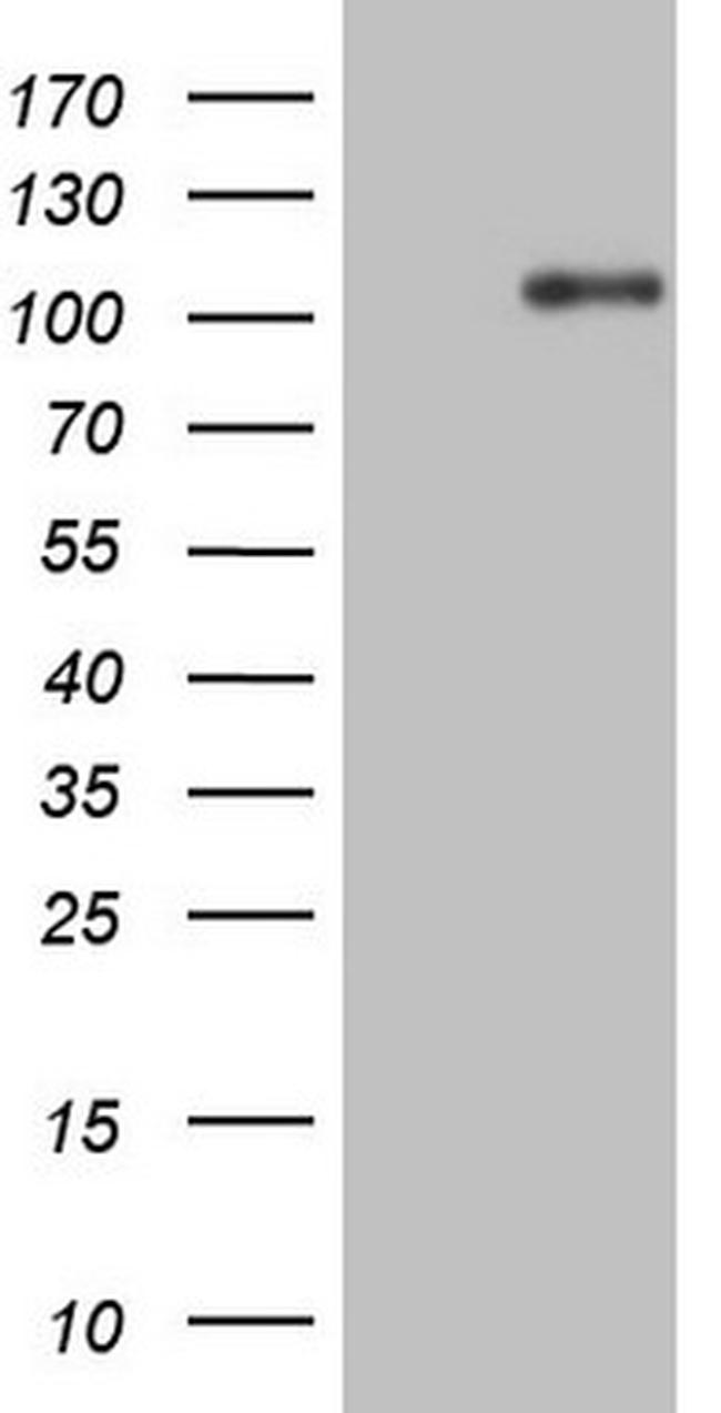 NTRK1 Antibody in Western Blot (WB)