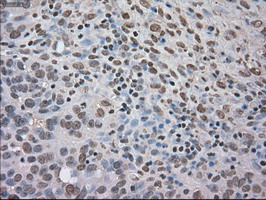 NTRK3 Antibody in Immunohistochemistry (Paraffin) (IHC (P))