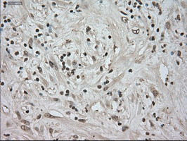 NTRK3 Antibody in Immunohistochemistry (Paraffin) (IHC (P))