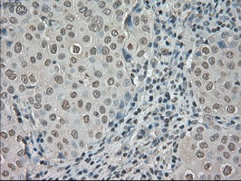 NTRK3 Antibody in Immunohistochemistry (Paraffin) (IHC (P))