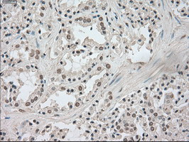 NTRK3 Antibody in Immunohistochemistry (Paraffin) (IHC (P))