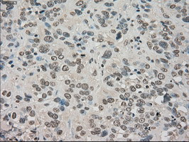 NTRK3 Antibody in Immunohistochemistry (Paraffin) (IHC (P))