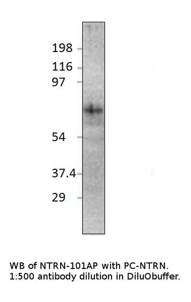 Netrin 1 Antibody in Western Blot (WB)