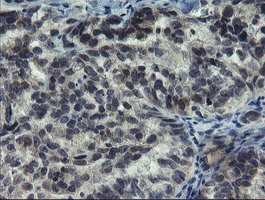 NUB1 Antibody in Immunohistochemistry (Paraffin) (IHC (P))