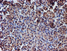 NUBPL Antibody in Immunohistochemistry (Paraffin) (IHC (P))