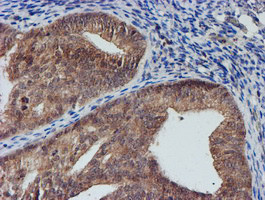 NUBPL Antibody in Immunohistochemistry (Paraffin) (IHC (P))