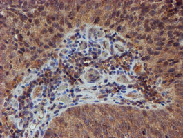 NUBPL Antibody in Immunohistochemistry (Paraffin) (IHC (P))