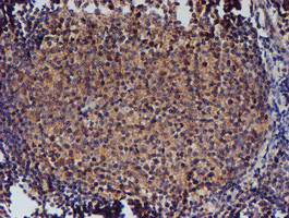 NUBPL Antibody in Immunohistochemistry (Paraffin) (IHC (P))