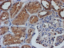 NUBPL Antibody in Immunohistochemistry (Paraffin) (IHC (P))