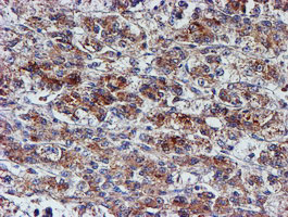 NUBPL Antibody in Immunohistochemistry (Paraffin) (IHC (P))