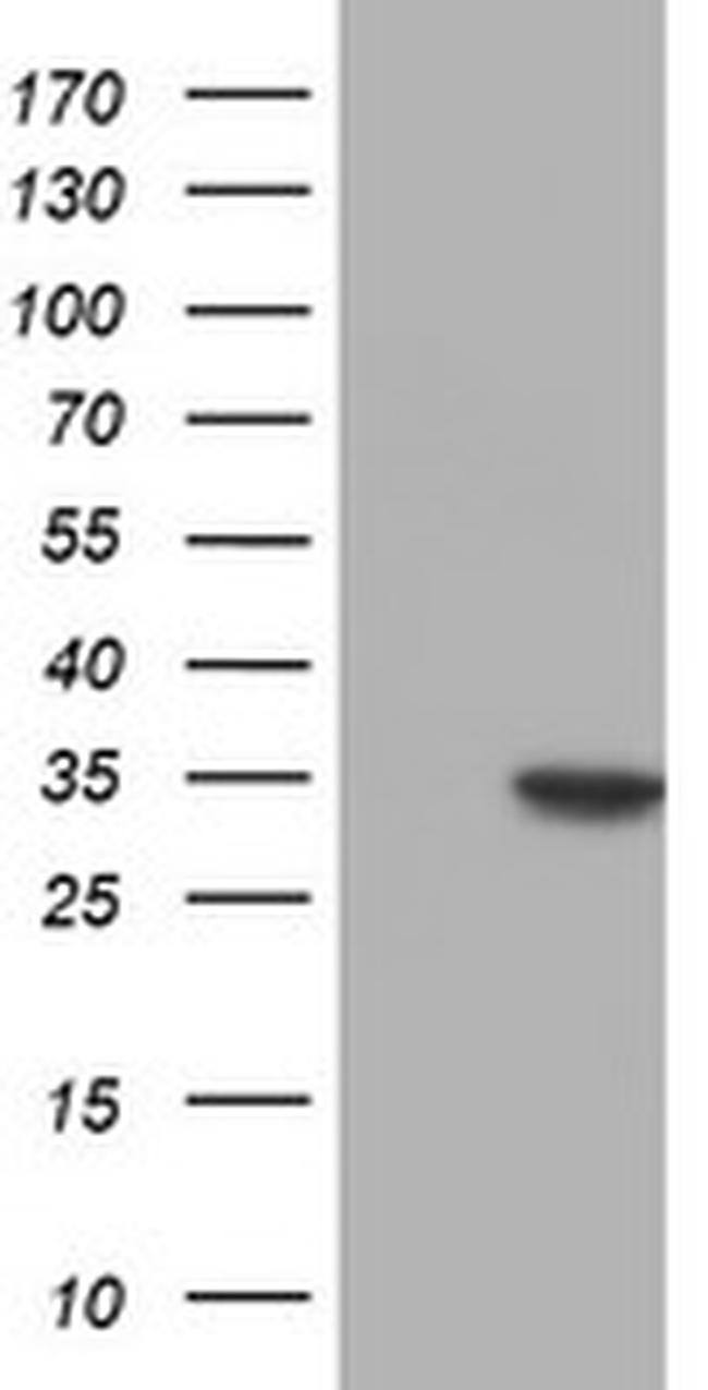 NUBPL Antibody in Western Blot (WB)