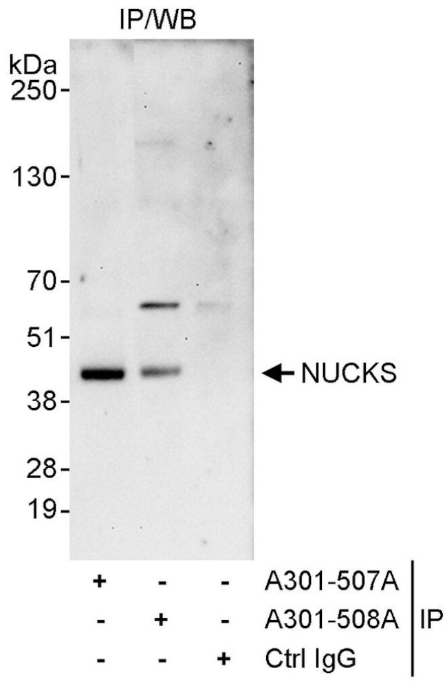 NUCKS Antibody in Immunoprecipitation (IP)