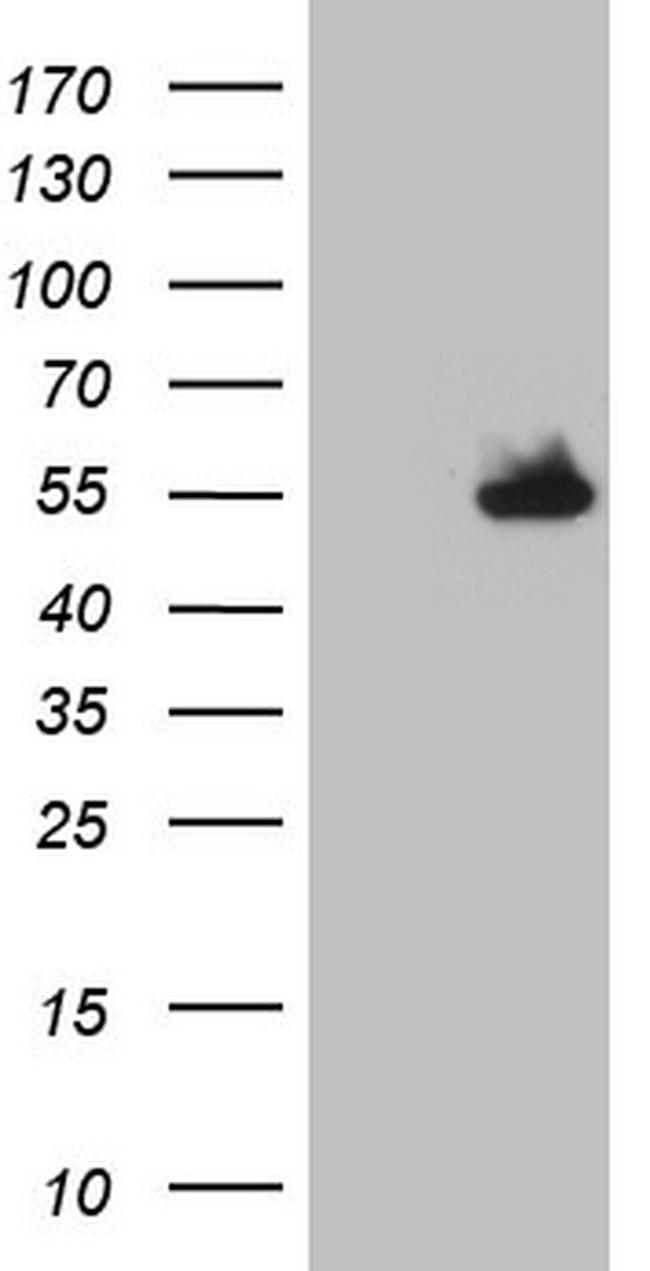 NUDT12 Antibody in Western Blot (WB)