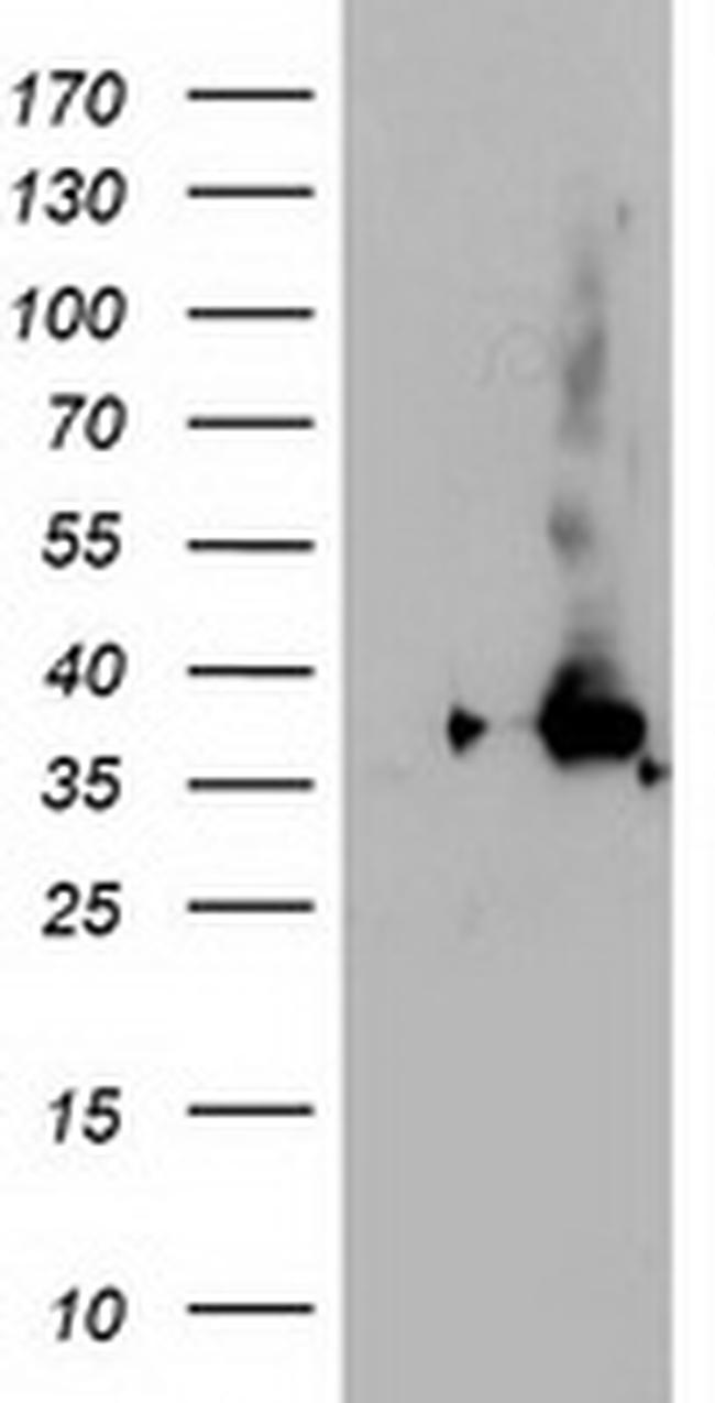 NUDT18 Antibody in Western Blot (WB)