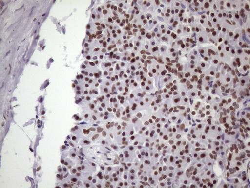 NUDT21 Antibody in Immunohistochemistry (Paraffin) (IHC (P))