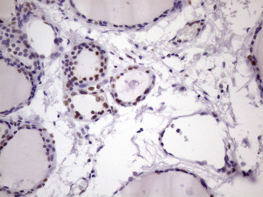 NUDT21 Antibody in Immunohistochemistry (Paraffin) (IHC (P))