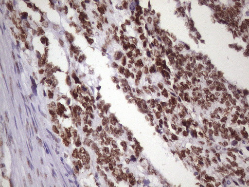 NUDT21 Antibody in Immunohistochemistry (Paraffin) (IHC (P))