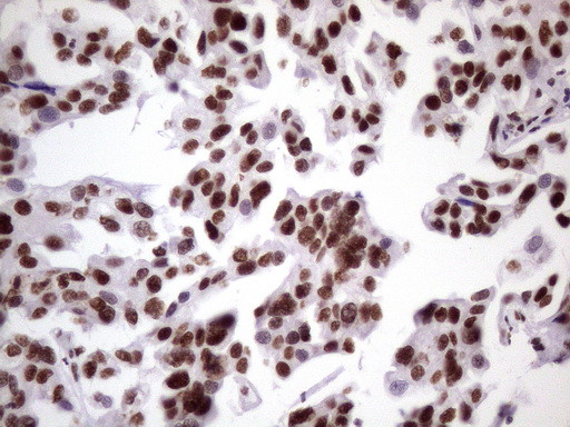 NUDT21 Antibody in Immunohistochemistry (Paraffin) (IHC (P))