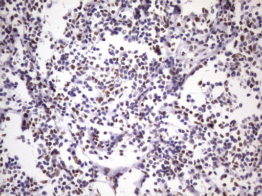 NUDT21 Antibody in Immunohistochemistry (Paraffin) (IHC (P))