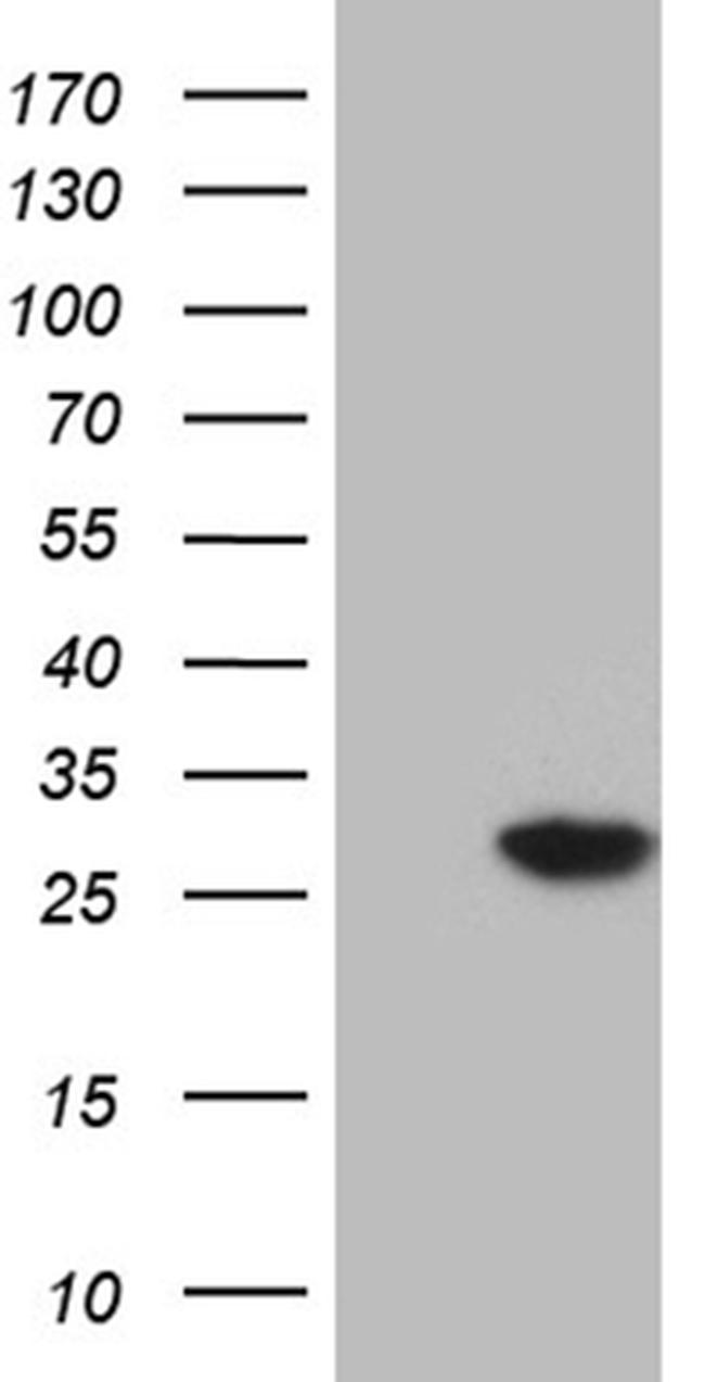 NUDT4 Antibody in Western Blot (WB)