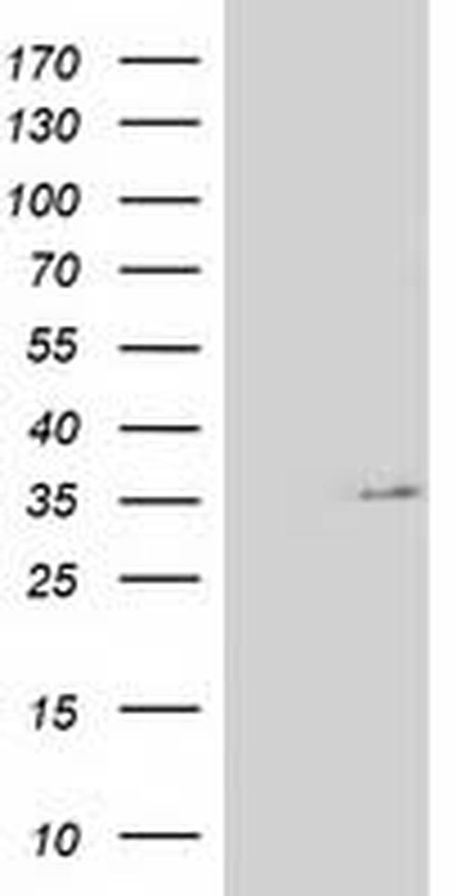 NUDT6 Antibody in Western Blot (WB)