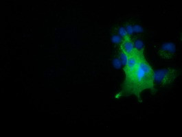 NUMB Antibody in Immunocytochemistry (ICC/IF)