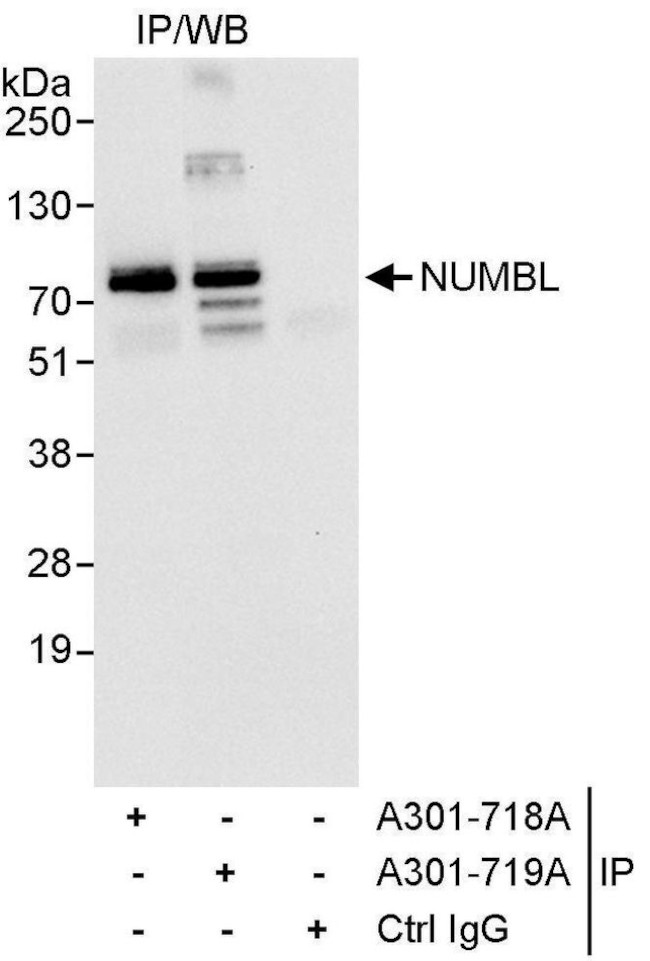 NUMBL Antibody in Immunoprecipitation (IP)