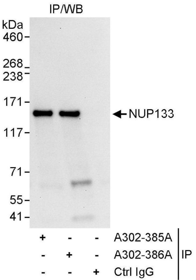 NUP133 Antibody in Immunoprecipitation (IP)