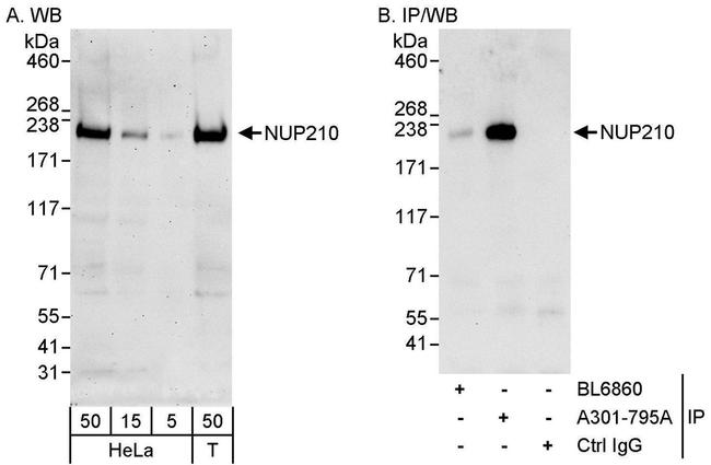 NUP210 Antibody in Western Blot (WB)
