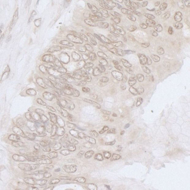 NUP35 Antibody in Immunohistochemistry (IHC)