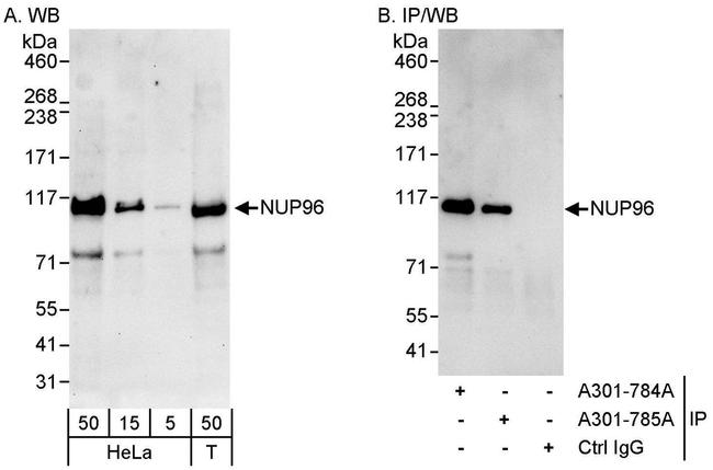 NUP96 Antibody in Western Blot (WB)