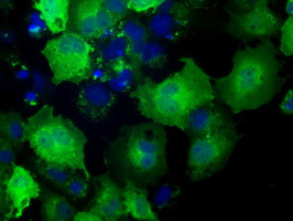 NXNL2 Antibody in Immunocytochemistry (ICC/IF)