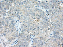 NXNL2 Antibody in Immunohistochemistry (Paraffin) (IHC (P))