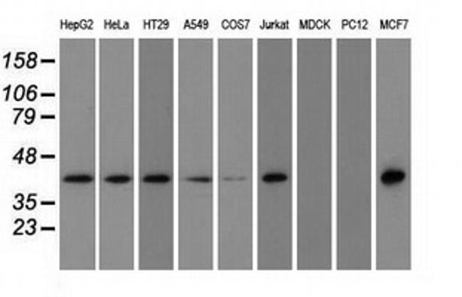 NXNL2 Antibody in Western Blot (WB)