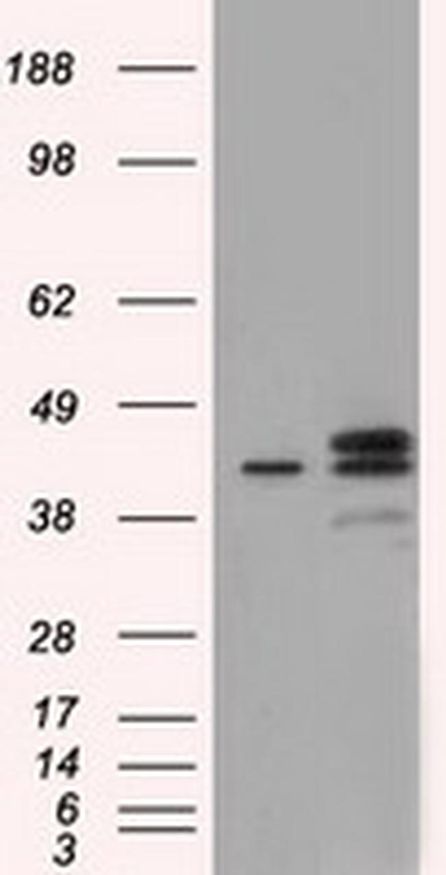 NXNL2 Antibody in Western Blot (WB)