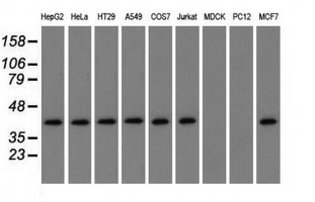 NXNL2 Antibody in Western Blot (WB)