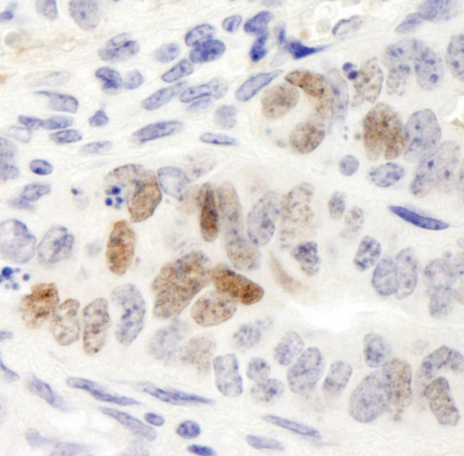 Nanog Antibody in Immunohistochemistry (IHC)