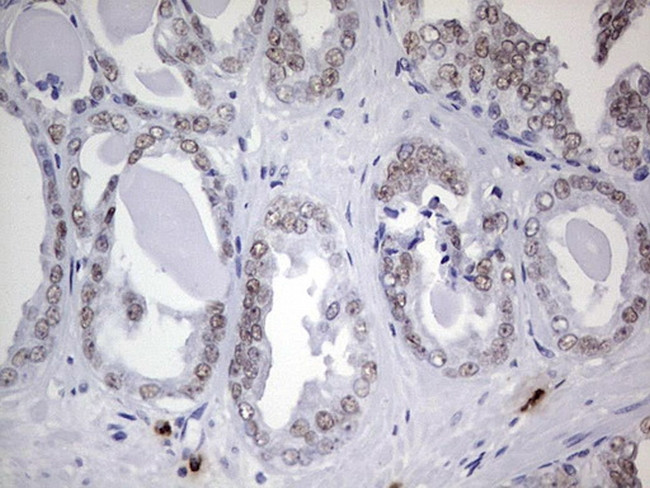 Nkx3.1 Antibody in Immunohistochemistry (Paraffin) (IHC (P))