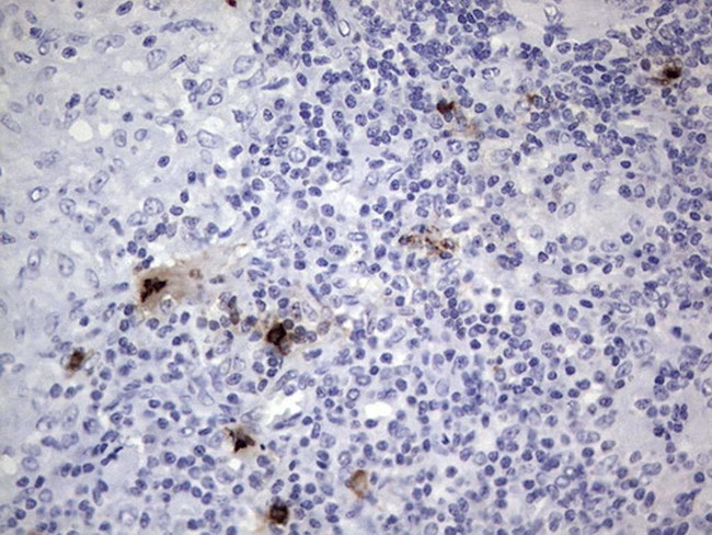 Nkx3.1 Antibody in Immunohistochemistry (Paraffin) (IHC (P))