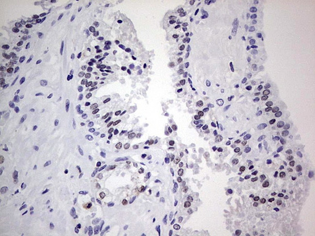 Nkx3.1 Antibody in Immunohistochemistry (Paraffin) (IHC (P))