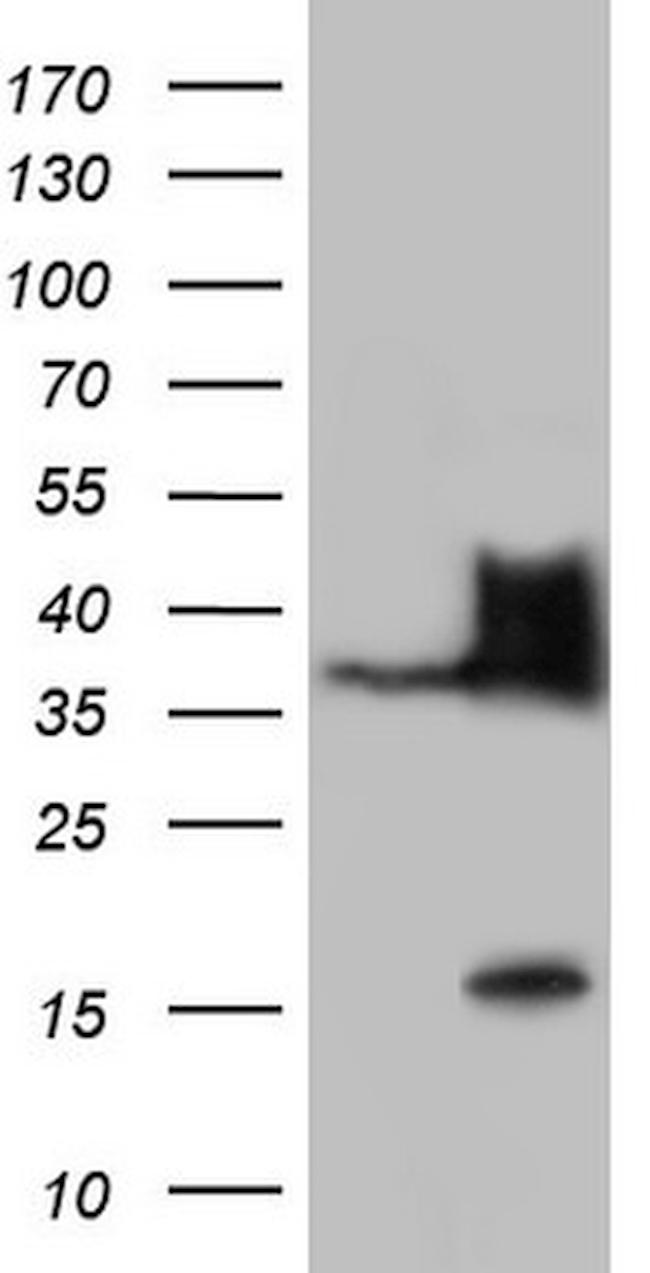 Nkx3.1 Antibody in Western Blot (WB)