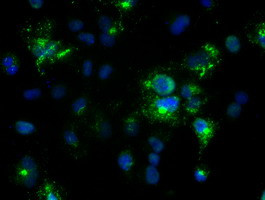 Noggin Antibody in Immunocytochemistry (ICC/IF)