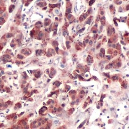 p70 S6 Kinase Antibody in Immunohistochemistry (IHC)