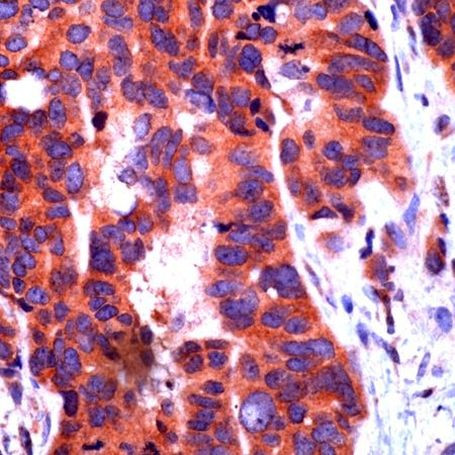 NOTCH1 Antibody in Immunohistochemistry (IHC)