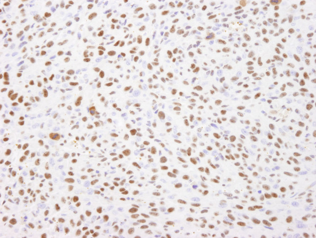 Nucleolin/NCL Antibody in Immunohistochemistry (IHC)