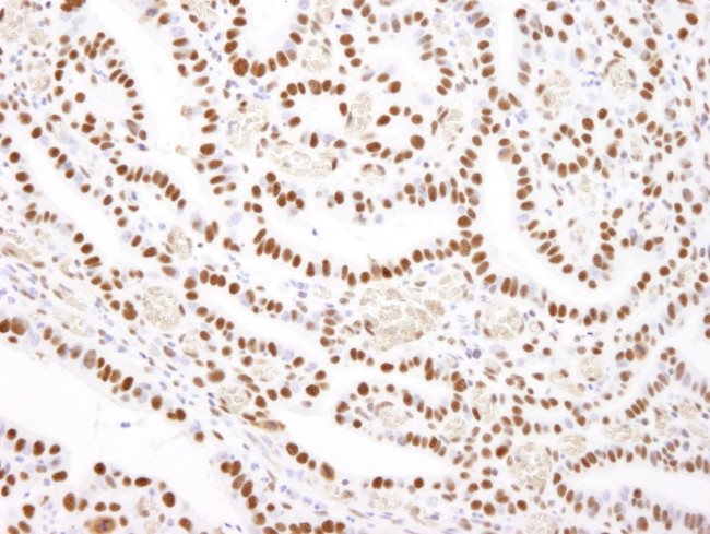 Nucleolin/NCL Antibody in Immunohistochemistry (IHC)