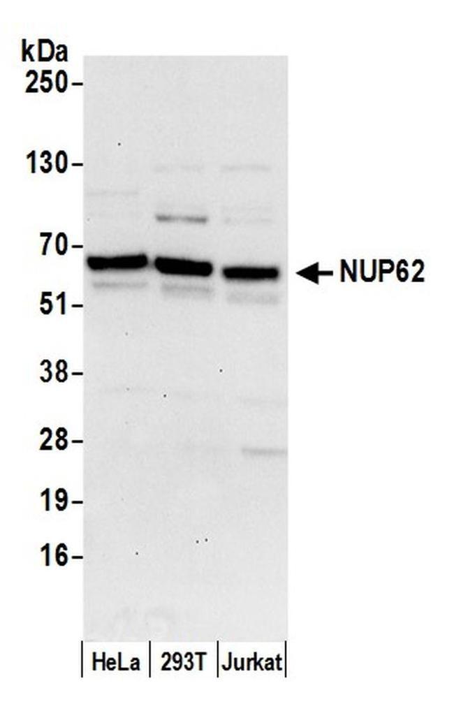 Nucleoporin p62/NUP62 Antibody in Western Blot (WB)