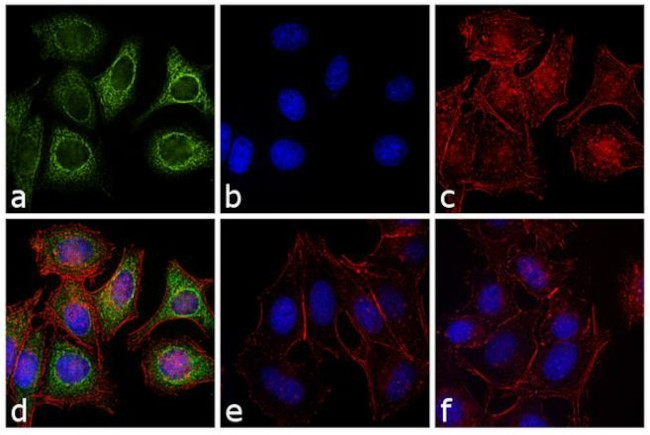 Mouse IgG (H+L) Secondary Antibody in Immunocytochemistry (ICC/IF)